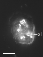 <i>Cochliopodium</i> sp., dark field showing crystals (xl). Scale = 10μm.
