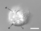 <i>Cochliopodium</i> sp., same cell as Fig 1, in the plane of the central cell mass; showing crystals (xl) and part of the extracellular tectum (t) with its embedded scales. Scale = 10μm.