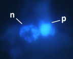 <i>Neoparamoeba</i> sp, detail showing nucleus (n) and parasome (p); scale bar = 5 μm. Note that the kinetoplast (mitochondrion) stains more strongly with the DNA-specific DAPI than the flanking endosymbiont nuclei or the host cell nuclei.