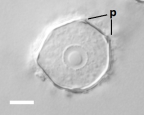 <i>Naegleria</i> sp. cyst, showing pores (p) and nucleus delineated by perinuclear granules