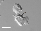 <i>Echinamoeba</i> sp. trophozoites, resting (above) and locomotive (below), showing nucleus (n). Scale = 5 μm.
